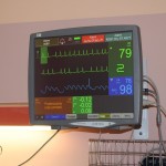 Kardiomonitory – „nowe oko” na pacjentów