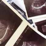 Aborcja – kontrowersyjny temat