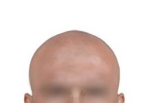 Policja ma rysopis bandyty