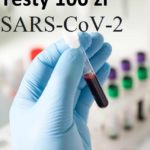 100 zł za test dot. koronawirusa