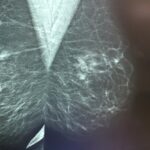 Miesiąc różowej wstążki, czyli mamo, siostro, żono zbadaj się.