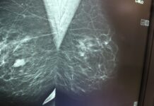 Miesiąc różowej wstążki, czyli mamo, siostro, żono zbadaj się.